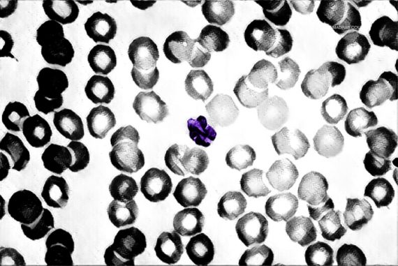 malaria_cells_microscope_illustration_madras_courier