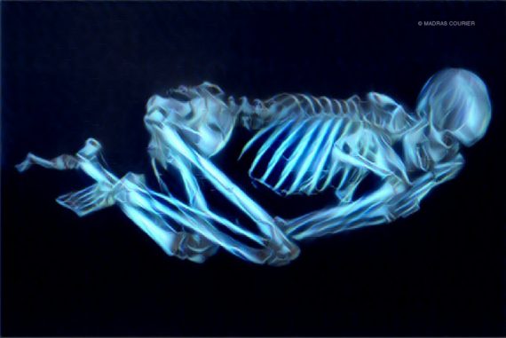 death_hallucinations_madras_courier