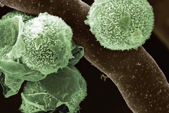 green_fungus_madras_courier