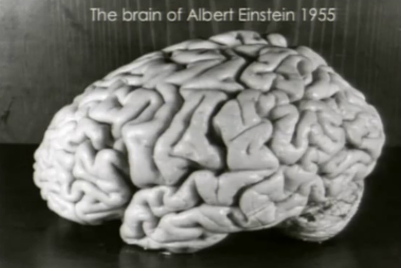 Einstein-Brain-Madras-Courier