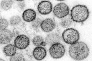 Hantavirus-Madras-Courier